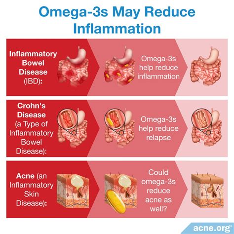 does omega 3 fight inflammation.